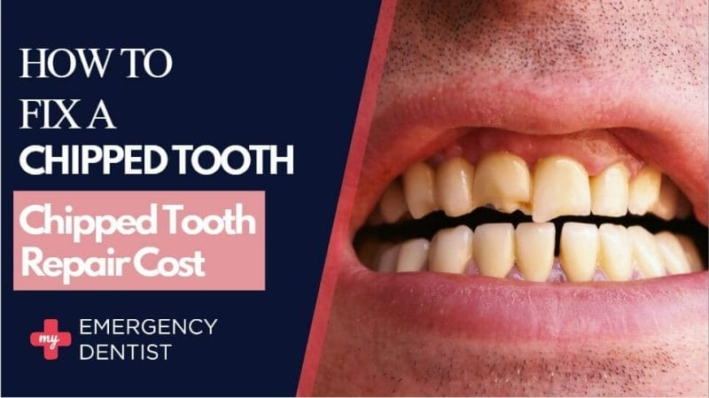 How To Fix A Chipped Tooth?