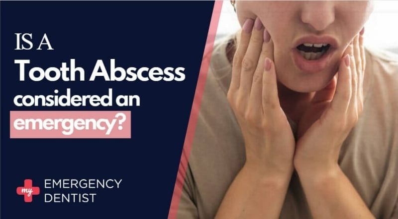 Is A Tooth Abscess Considered An Emergency?