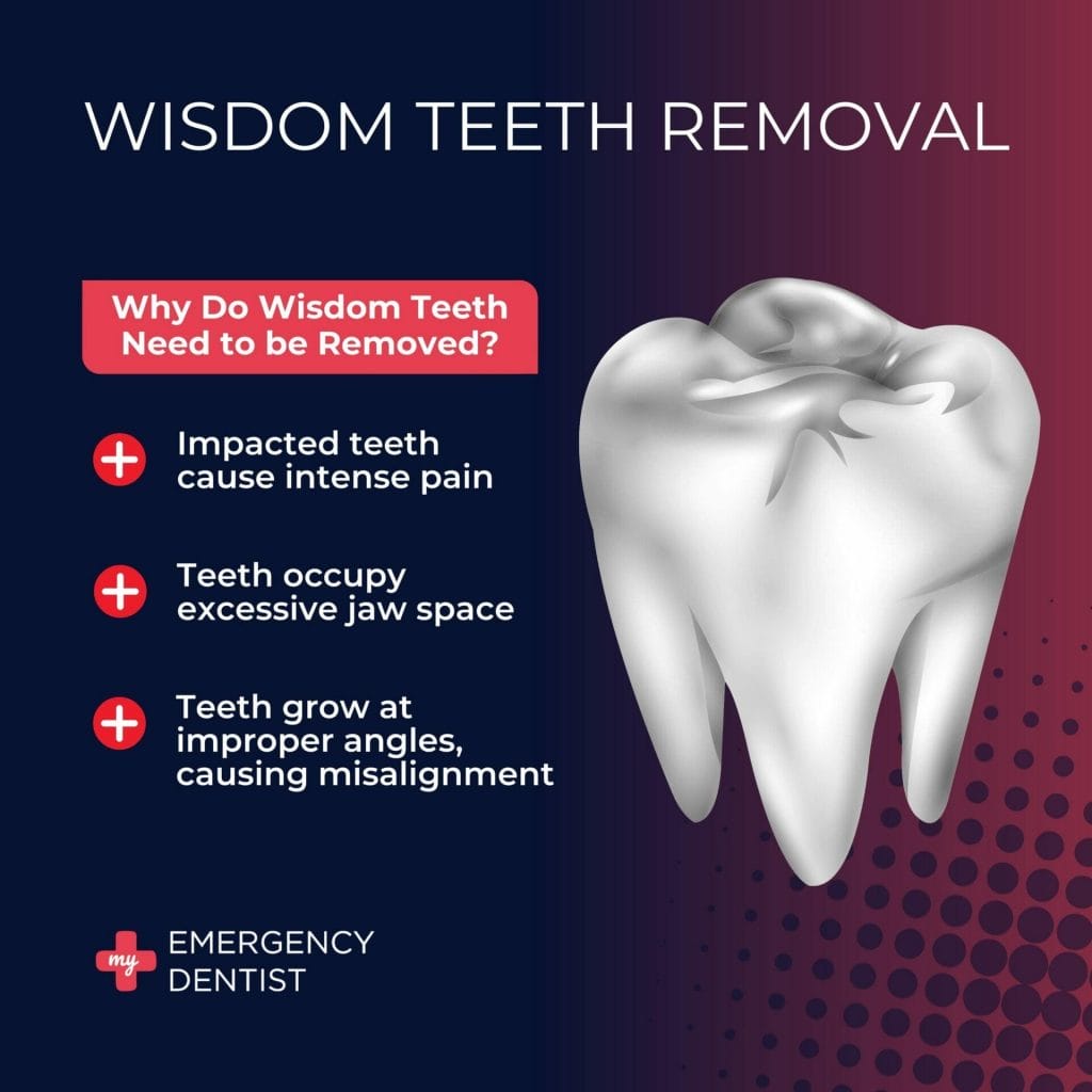 Why Do Wisdom Teeth Need To Be Removed?