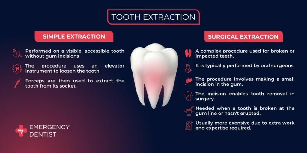 Simple extraction vs surgical deals extraction