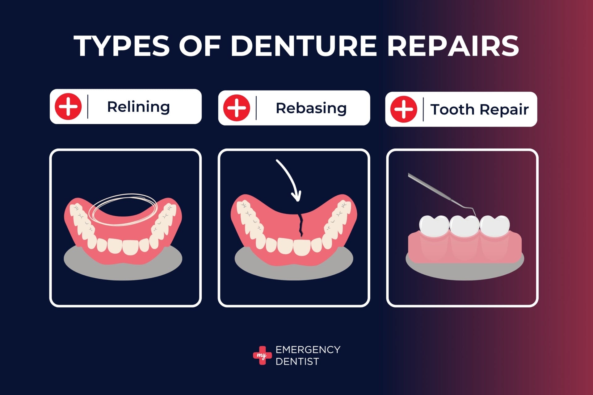 Types of Emergency Denture Repairs Perth